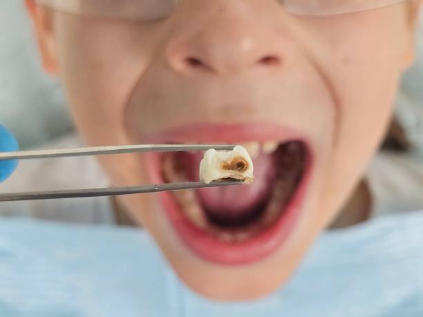 Best Tooth Infection Emergency Dentist  in Miamitown, OH